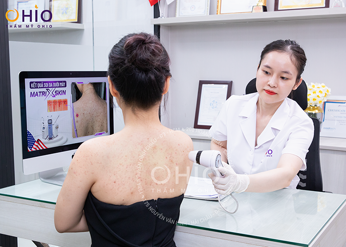 Chị Hoàng Huyền: Hành trình vượt qua nỗi ám ảnh mang tên “Viêm nang lông” - Phòng khám da liễu OHIO viêm nang lông