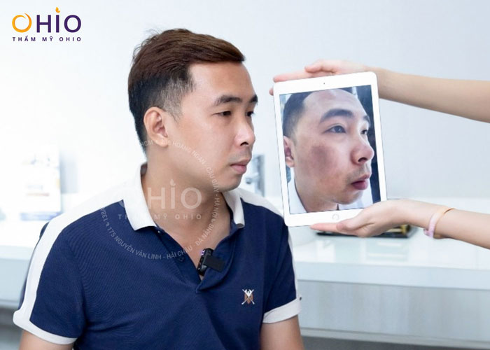 Bớt tăng sinh sắc tố là gì? Nguyên nhân và cách điều trị hiệu quả - Phòng khám da liễu OHIO Bớt tăng sinh sắc tố là gì? Nguyên nhân và cách điều trị hiệu quả