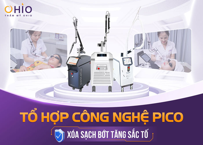 Bớt tăng sinh sắc tố là gì? Nguyên nhân và cách điều trị hiệu quả - Phòng khám da liễu OHIO Bớt tăng sinh sắc tố là gì? Nguyên nhân và cách điều trị hiệu quả