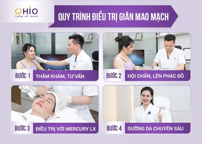 Trị giãn mao mạch hiệu quả với laser xung dài tại Phòng khám chuyên khoa da liễu OHIO
