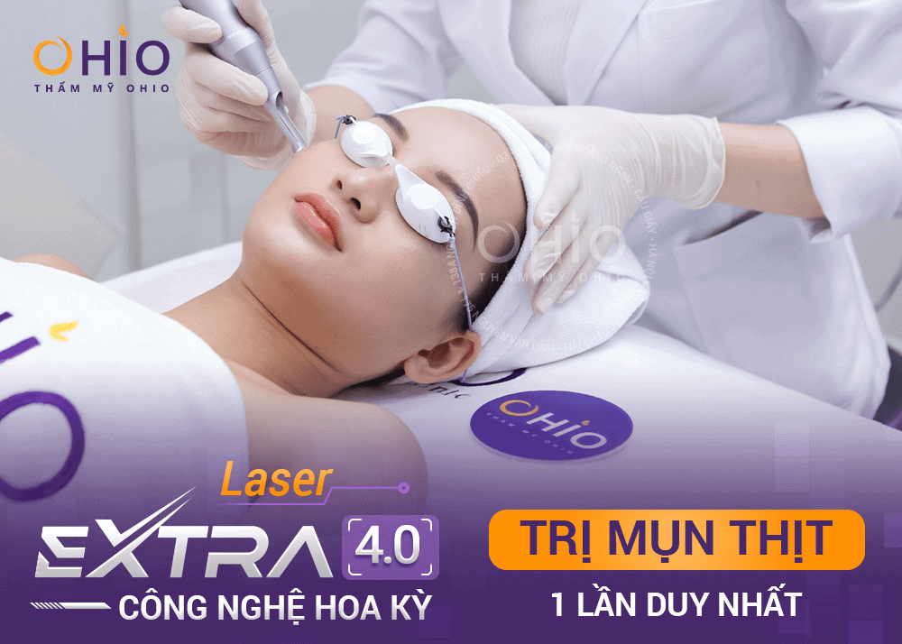 Điều trị mụn thịt Laser Extra: Hiệu quả, nhanh chóng, an toàn, - Phòng khám da liễu OHIO Điều trị mụn thịt Laser Extra: Hiệu quả, nhanh chóng, an toàn,