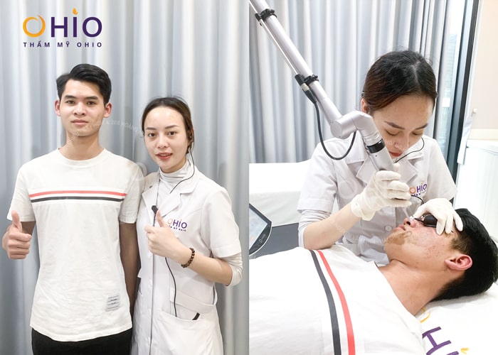 Chàm bớt nâu cà phê là gì? Cách điều trị hiệu quả, an toàn - Phòng khám da liễu OHIO Chàm bớt nâu cà phê là gì? Cách điều trị hiệu quả, an toàn