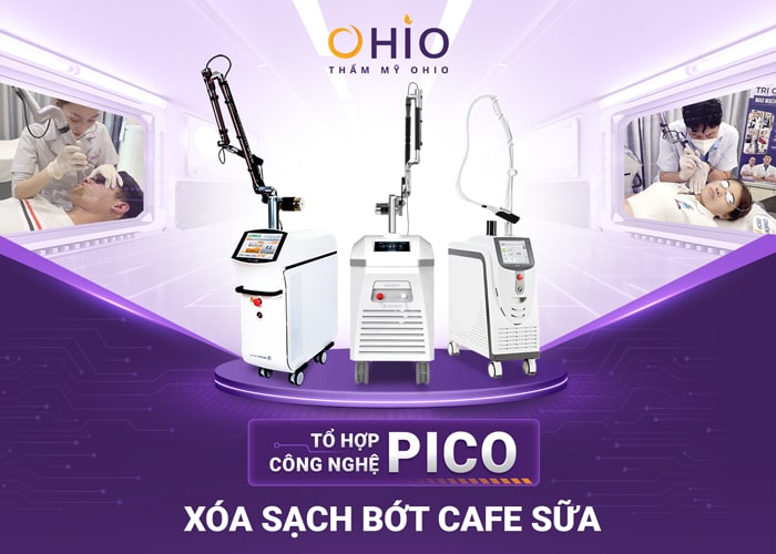 Chàm bớt nâu cà phê là gì? Cách điều trị hiệu quả, an toàn - Phòng khám da liễu OHIO xoá sạch chàm bớt nâu cafe sữa