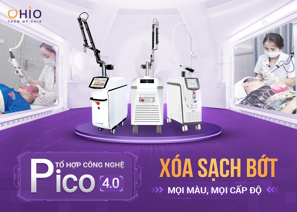 Xóa chàm bớt sắc tố hiệu quả với tổ hợp công nghệ Laser Pico - Phòng khám da liễu OHIO xóa chàm bớt sắc tố 1
