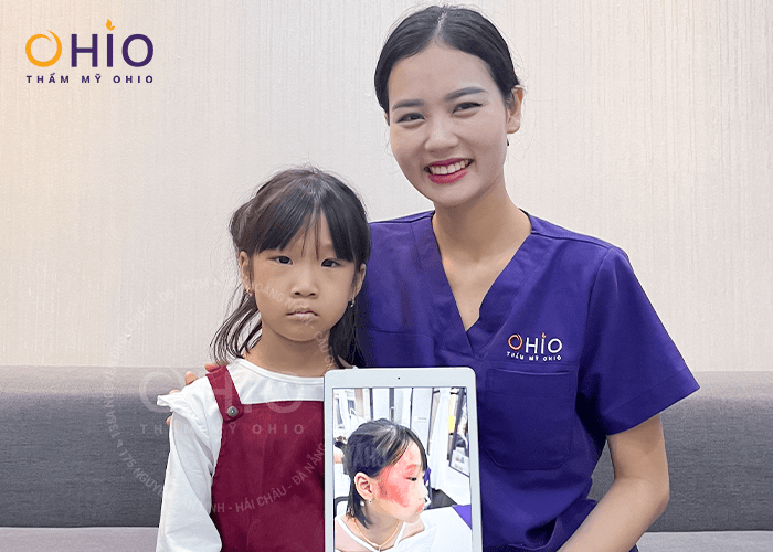 Con gái sạch bớt rượu vang, mẹ “vỡ òa” hạnh phúc - Phòng khám da liễu OHIO Con gái sạch bớt rượu vang, mẹ “vỡ òa” hạnh phúc
