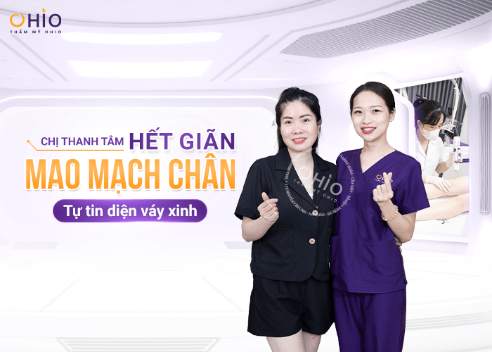 Chị Thanh Tâm: Hết giãn mao mạch chân - tự tin diện váy xinh - Phòng khám da liễu OHIO đôi chân giãn mao mạch