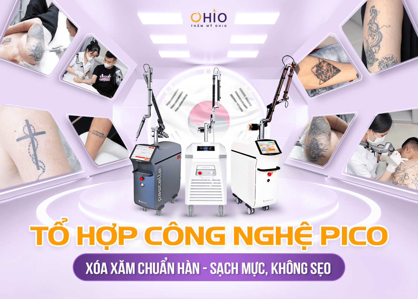 xoá hình xăm