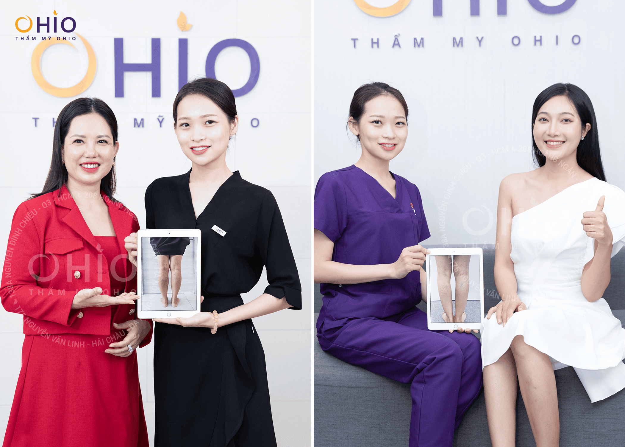 Chi phí điều trị giãn mao mạch tốt 2023 chỉ có tại Thẩm mỹ OHIO - Phòng khám da liễu OHIO Chi phí điều trị giãn mao mạch tốt 2023 chỉ có tại Thẩm mỹ OHIO