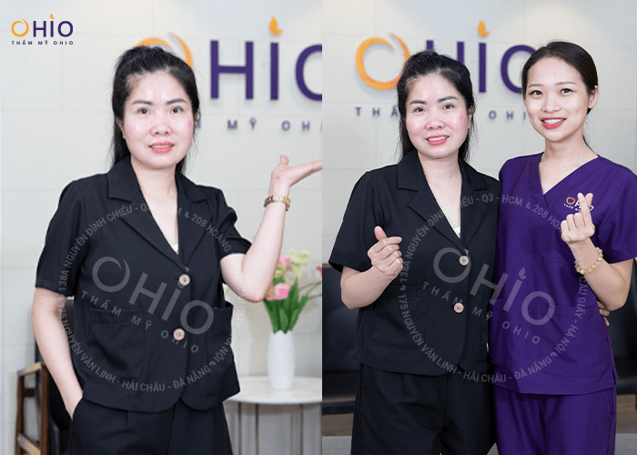 Chị Thanh Tâm: Hết giãn mao mạch chân - tự tin diện váy xinh - Phòng khám da liễu OHIO Chị Thanh Tâm: Hết giãn mao mạch chân - tự tin diện váy xinh