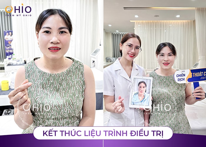 Thoát “ám ảnh” bớt ota xanh đen xấu xí gắn liền suốt 40 năm