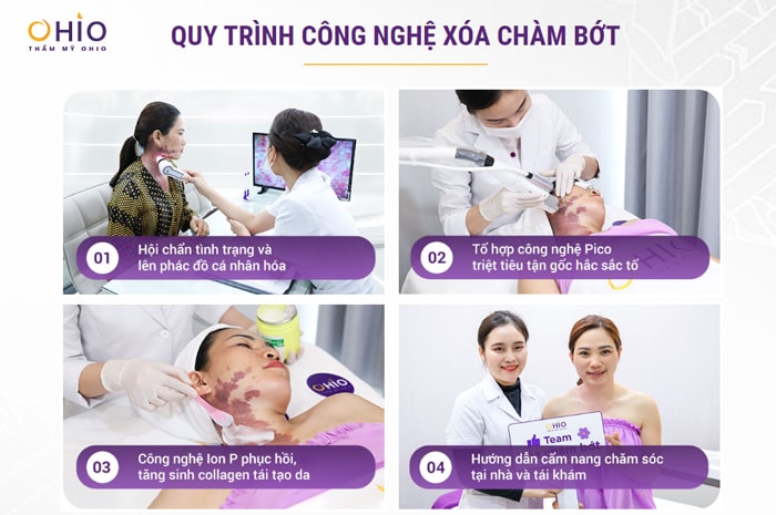 Bớt sắc tố bẩm sinh: Những điều cần biết và cách điều trị an toàn, hiệu quả - Phòng khám da liễu OHIO Bớt sắc tố bẩm sinh: Những điều cần biết và cách điều trị an toàn, hiệu quả