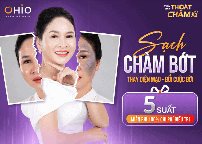 Chiến dịch Thoát chàm 2024 trao cơ hội xóa chàm bớt thay diện mạo đổi cuộc đời cho hàng ngàn khách hàng - Phòng khám da liễu OHIO Chiến dịch Thoát chàm 2024 trao cơ hội xóa chàm bớt thay diện mạo đổi cuộc đời cho hàng ngàn khách hàng