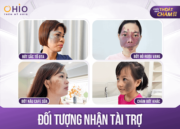 Chiến dịch Thoát Chàm 2024 tài trợ xoá chàm miễn phí 3 tỷ đồng - Phòng khám da liễu OHIO Chiến dịch Thoát Chàm 2024 tài trợ xoá chàm miễn phí 3 tỷ đồng