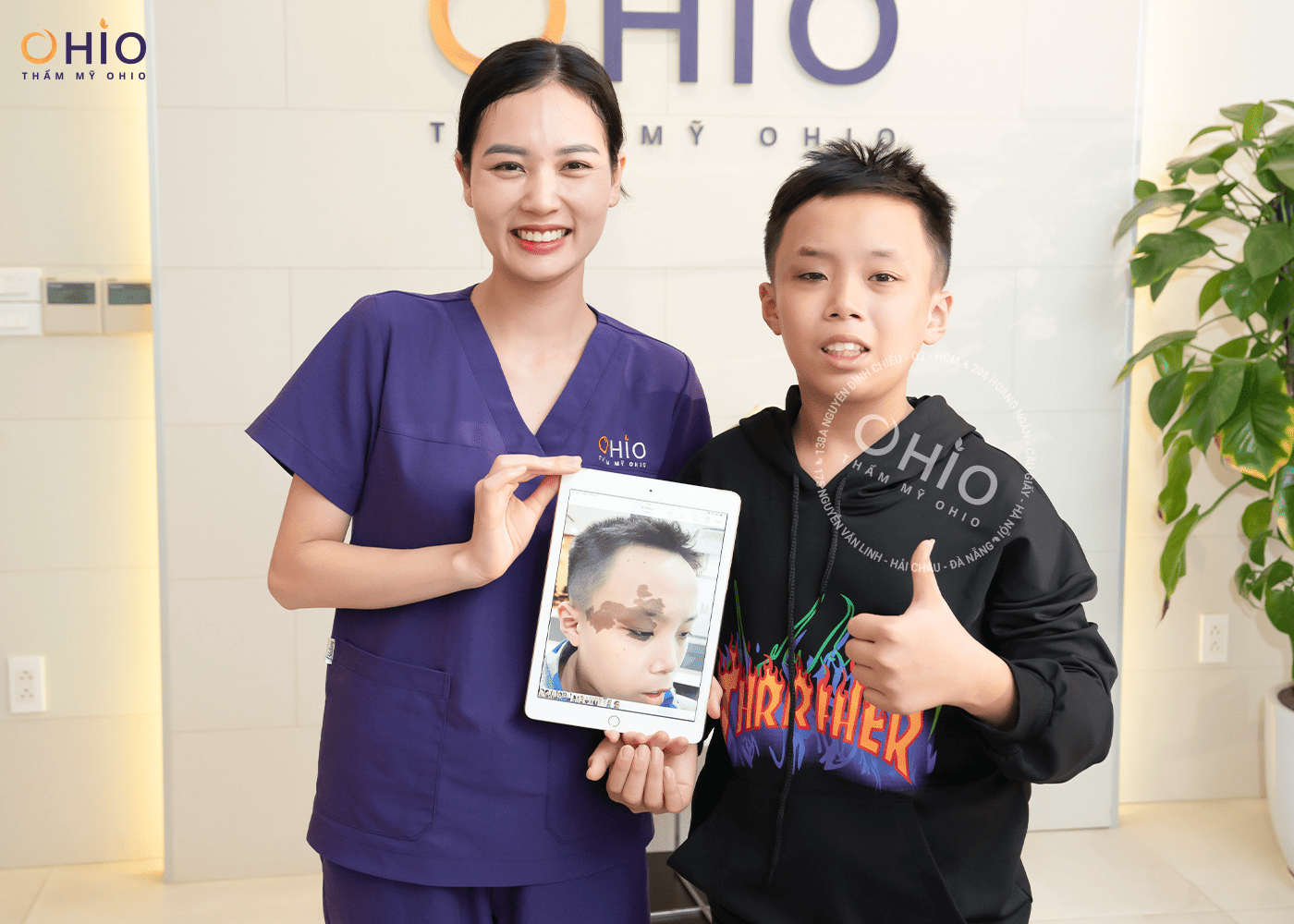 Gia đình Đức Anh: Lựa chọn xóa chàm cho con tại OHIO là sáng suốt! - Phòng khám da liễu OHIO Gia đình Đức Anh: Lựa chọn xóa chàm cho con tại OHIO là sáng suốt!