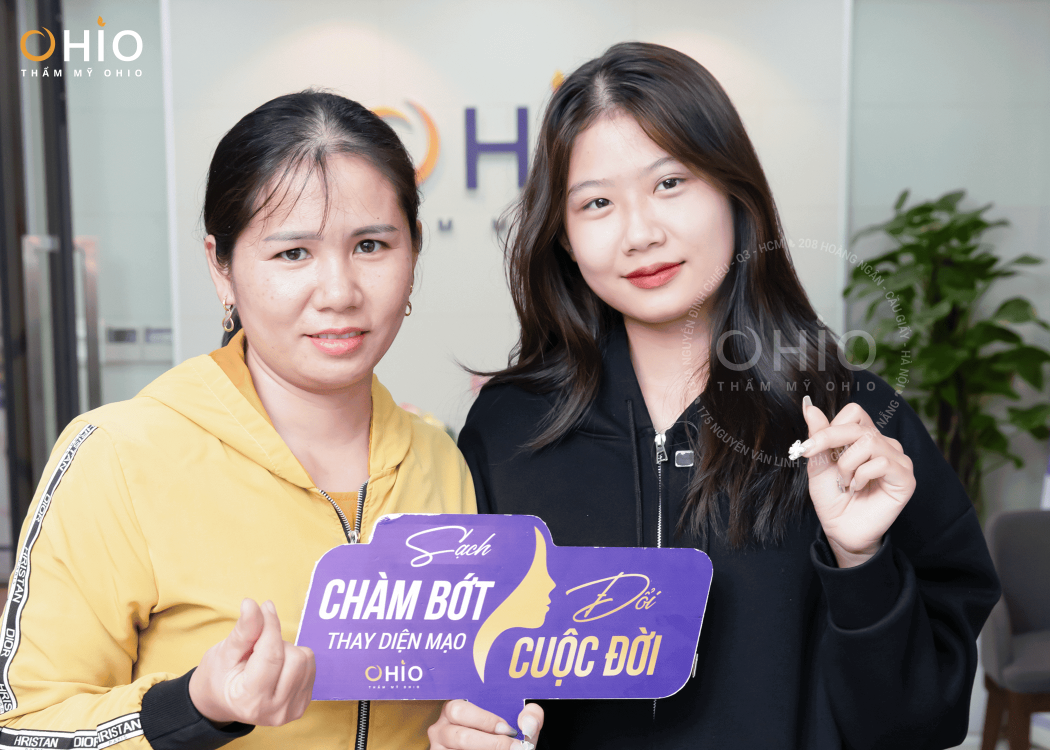 bớt xanh ota bẩm sinh