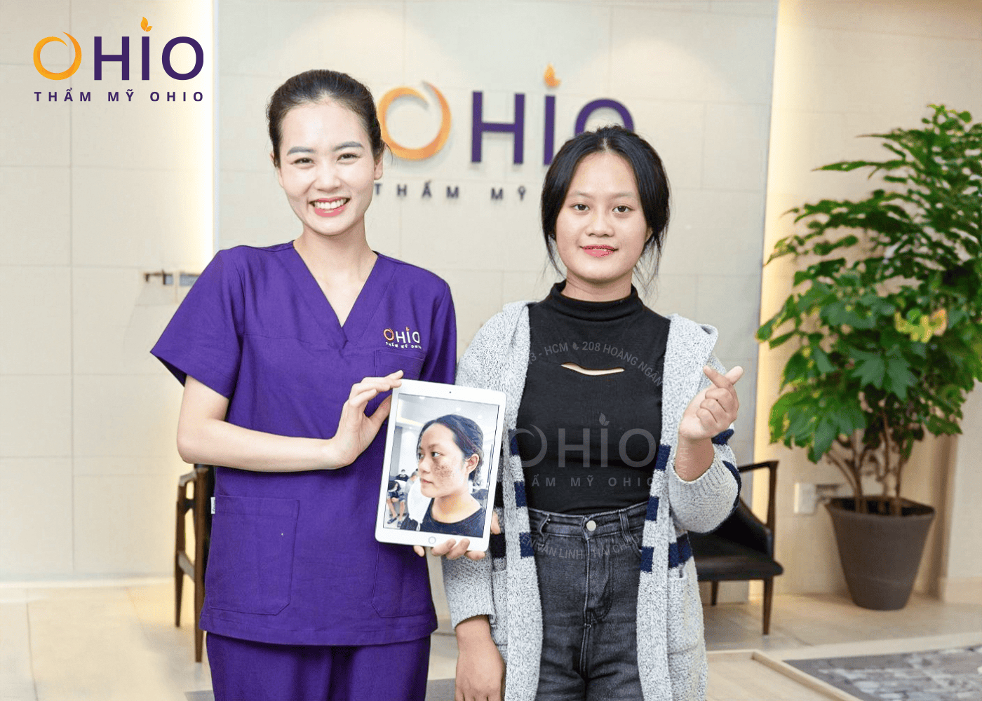 Thùy Dung: Xóa sạch chàm bớt, tương lai rộng mở - Phòng khám da liễu OHIO Thùy Dung: Xóa sạch chàm bớt, tương lai rộng mở