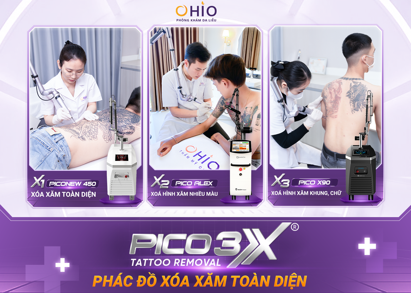 Xóa hình xăm sạch mực với phác đồ PICO 3X 2025 - Phòng khám da liễu OHIO xóa hình xăm