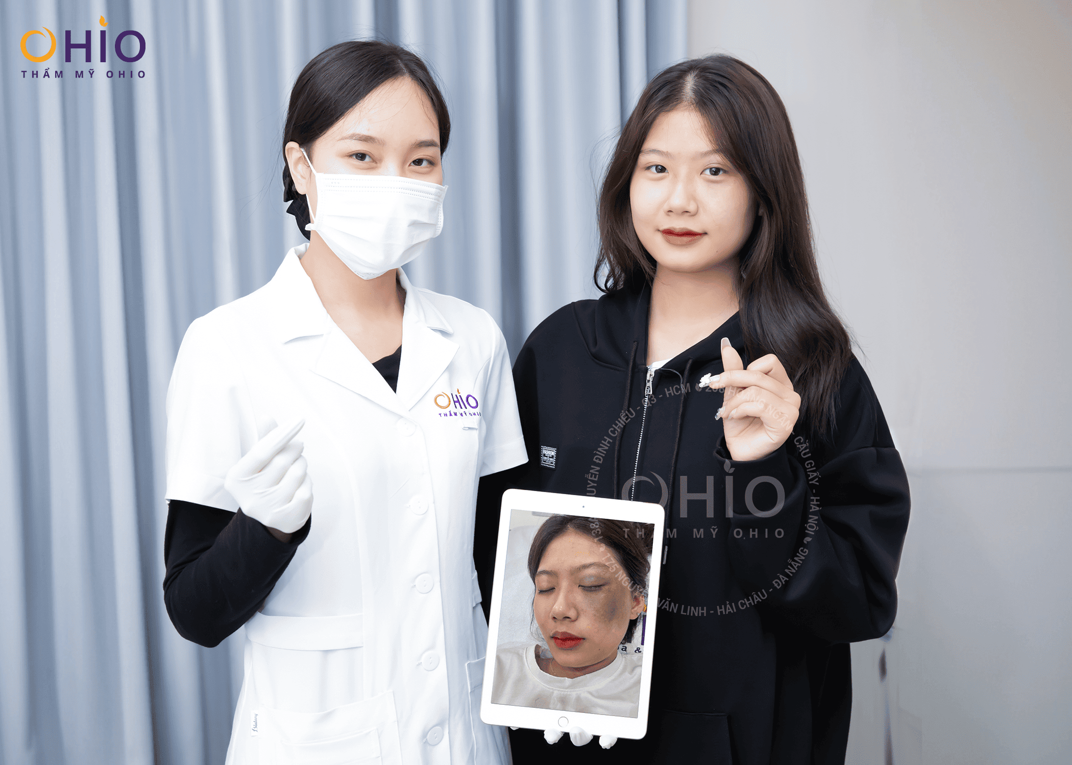 CHÀM BỚT BẨM SINH