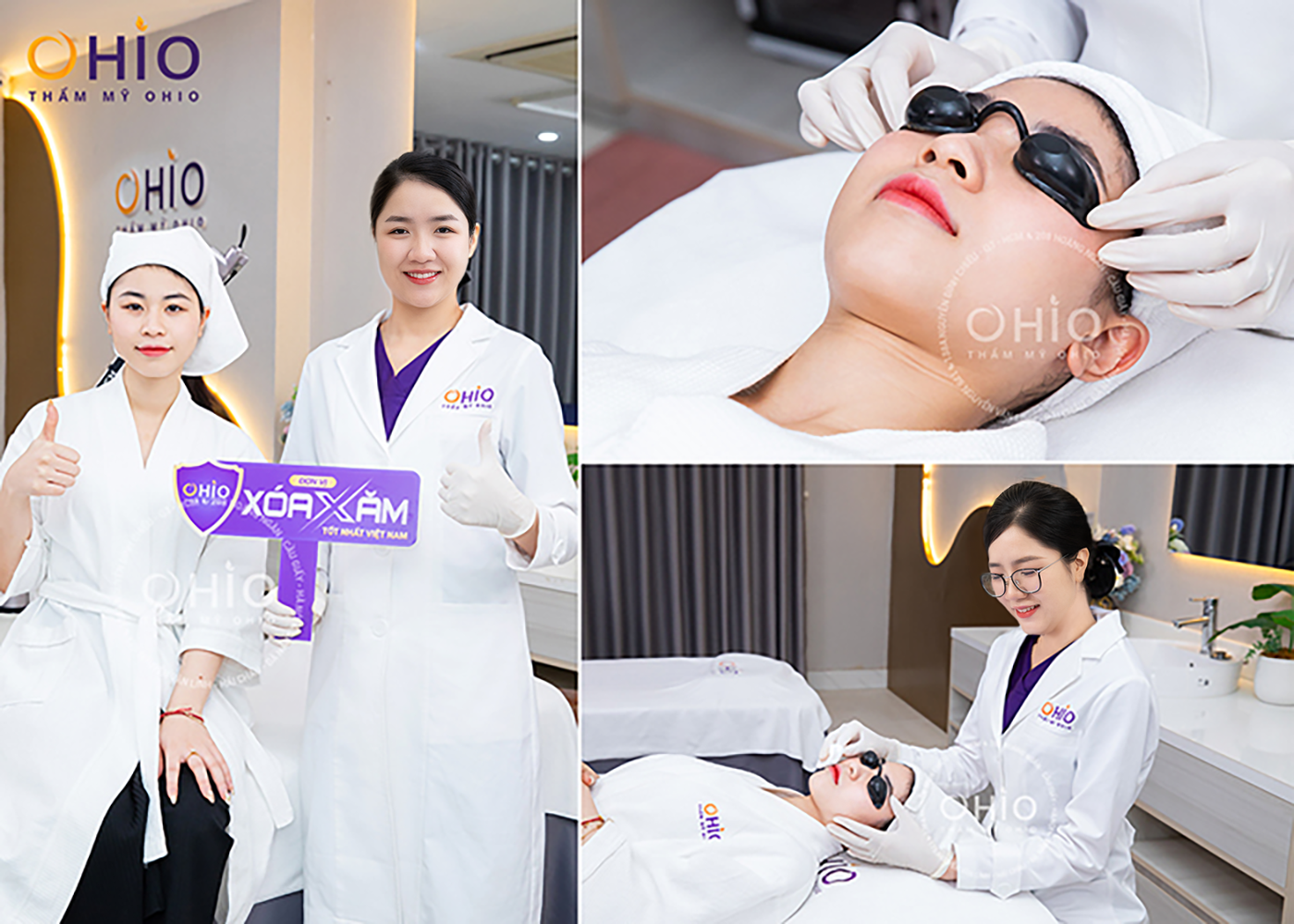 Xóa xăm môi hiệu quả - tối ưu thời gian