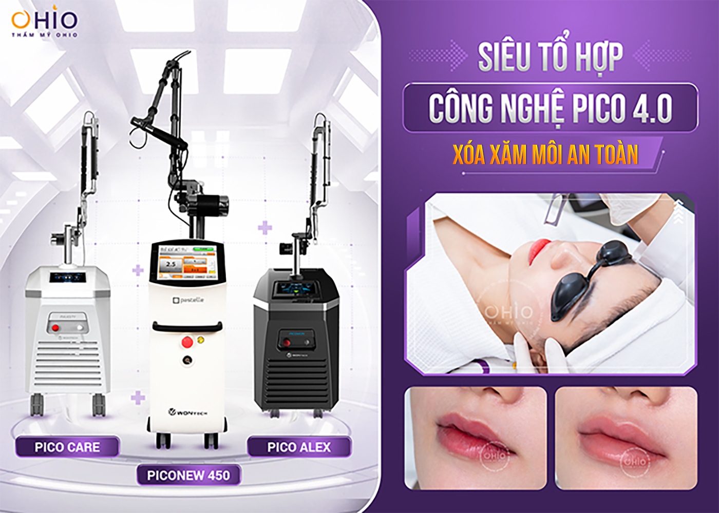Xóa xăm môi hiệu quả - tối ưu thời gian