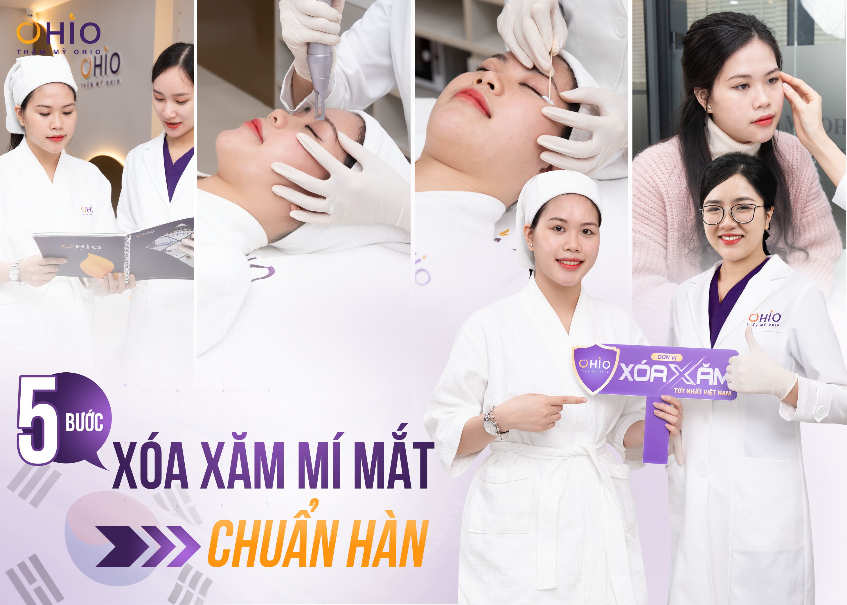 Xóa xăm mí mắt tiết kiệm thời gian, an toàn, hiệu quả 2025