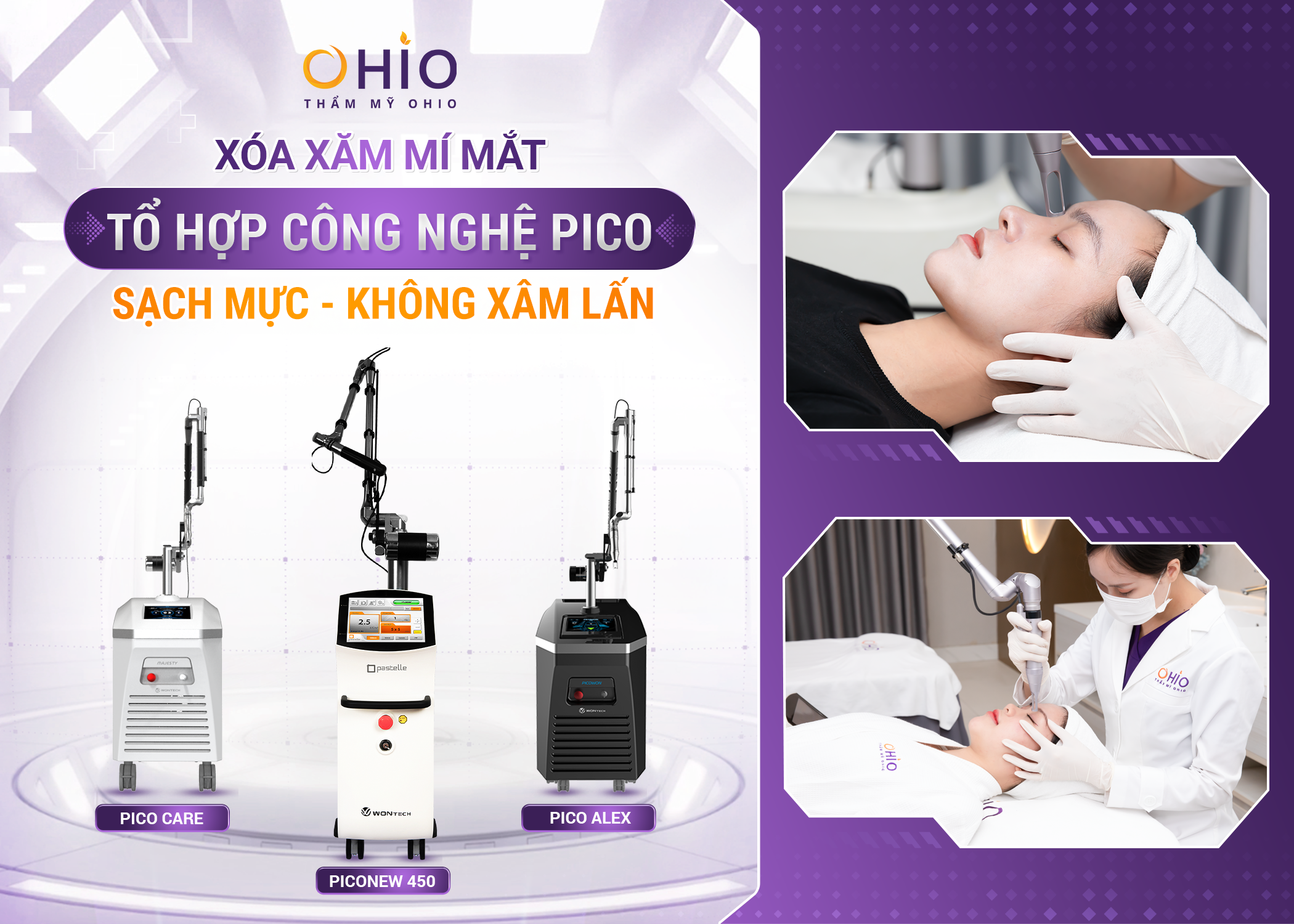 Xóa xăm mí mắt bằng công nghệ cao