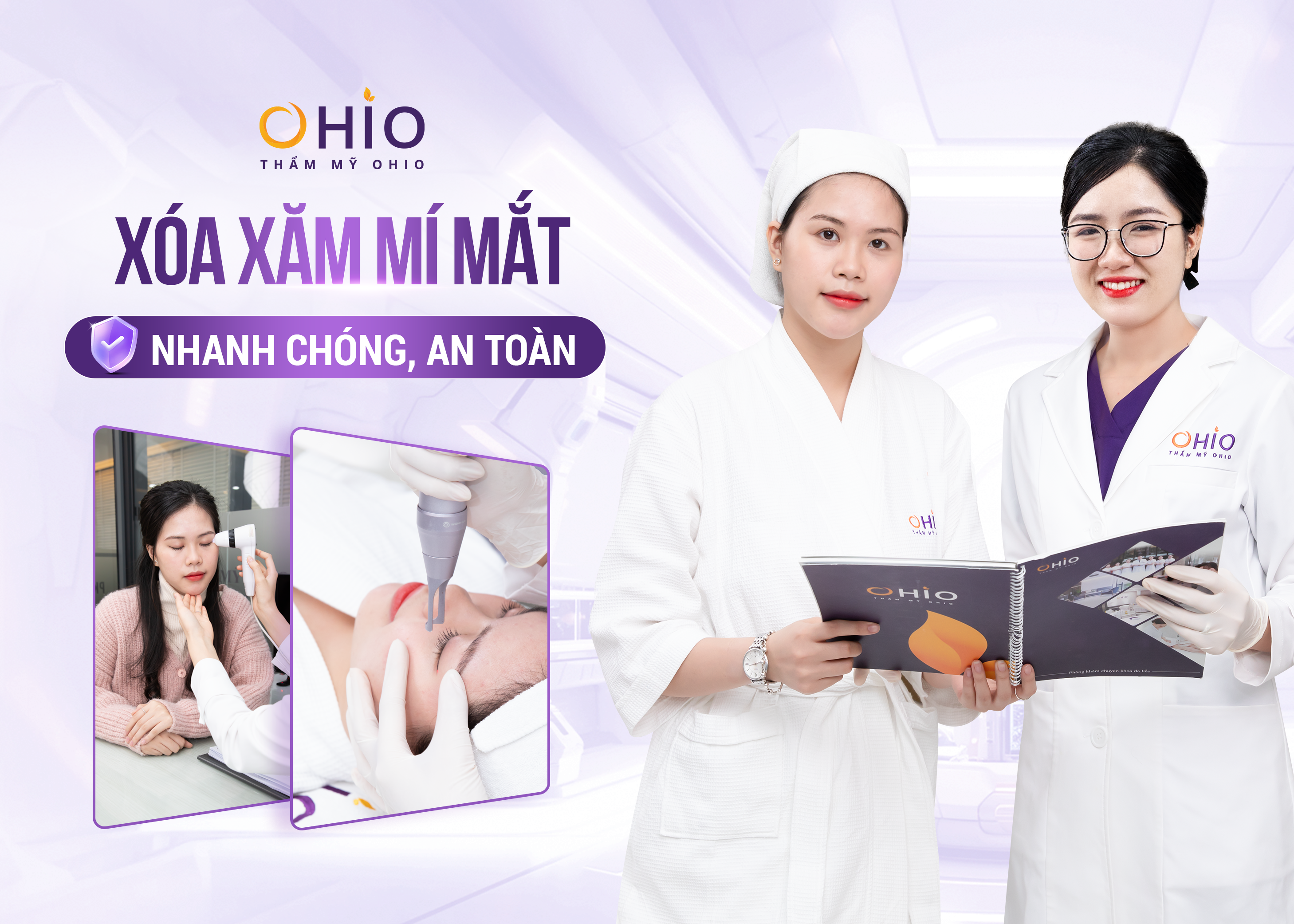 Xóa xăm mí mắt tiết kiệm thời gian, an toàn, hiệu quả 2025