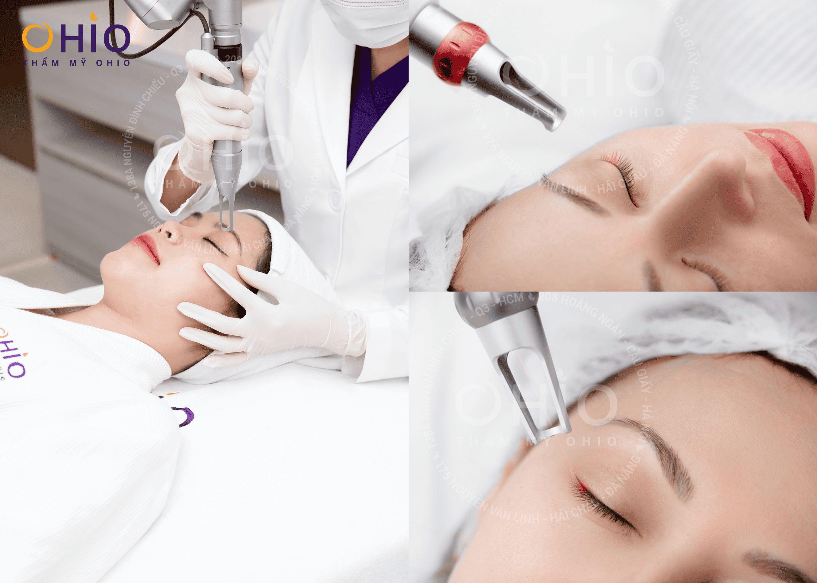 Xóa xăm mí mắt nhanh chóng