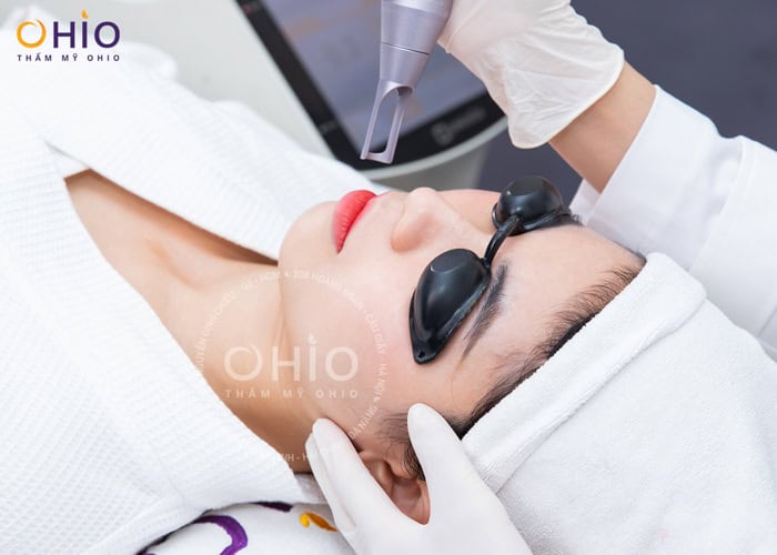 Xóa xăm môi hiệu quả 