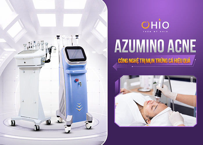Trị mụn trứng cá Azumino Acne hiệu quả, an toàn