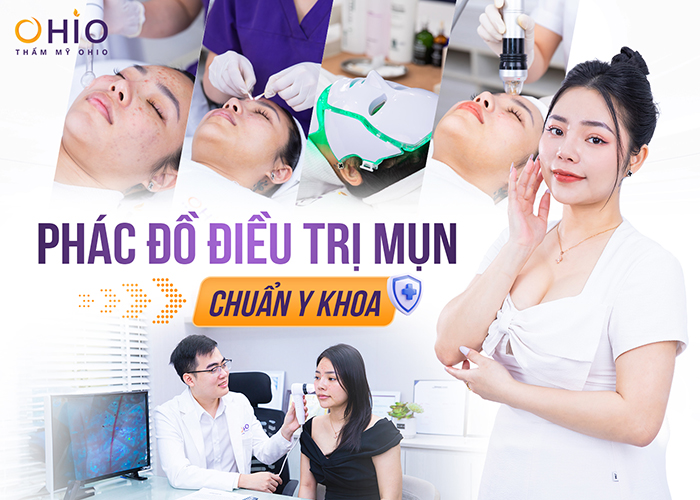 Trị mụn trứng cá Azumino Acne hiệu quả, an toàn - Phòng khám da liễu OHIO Trị mụn trứng cá Azumino Acne hiệu quả, an toàn