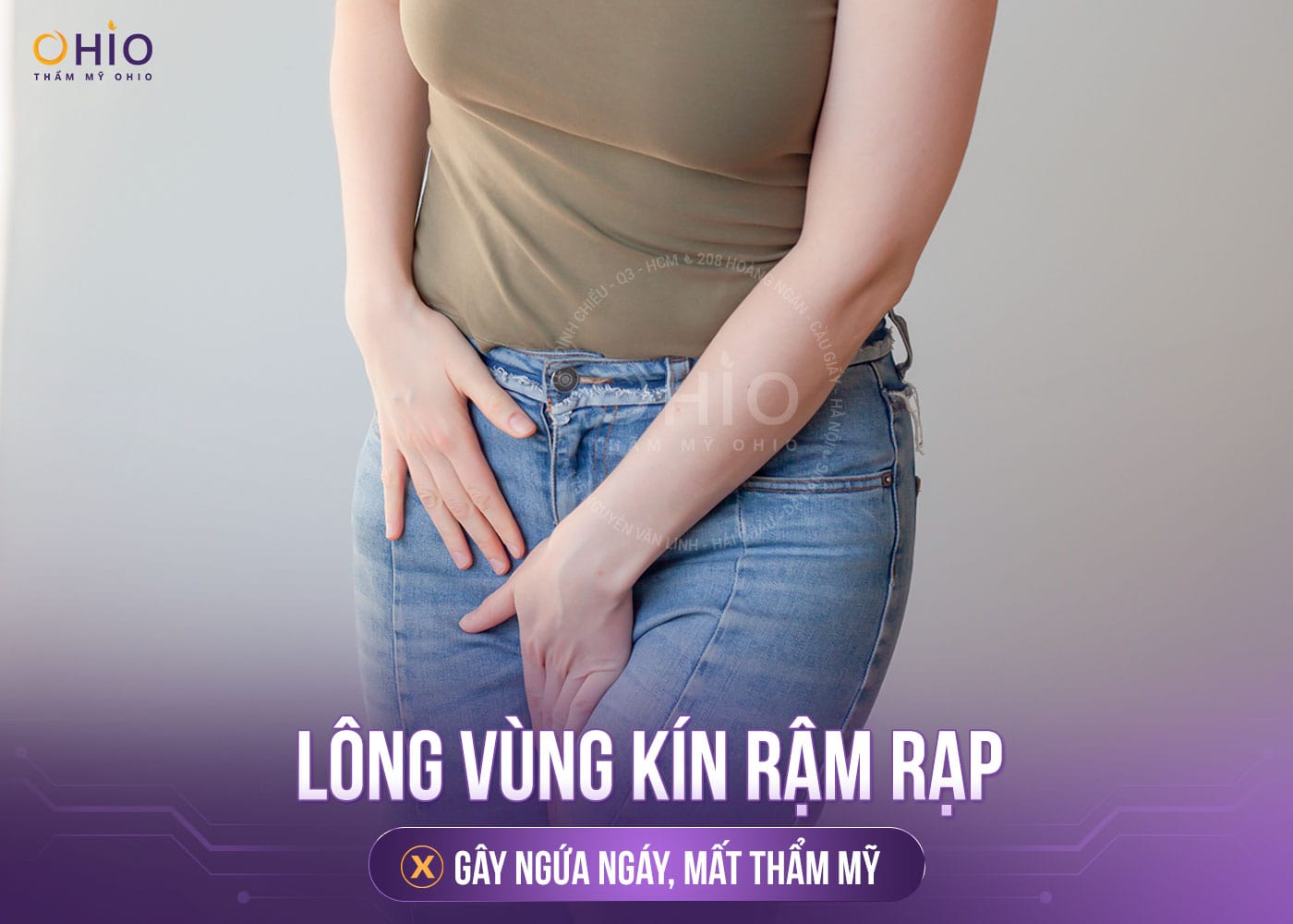 triệt lông bikini