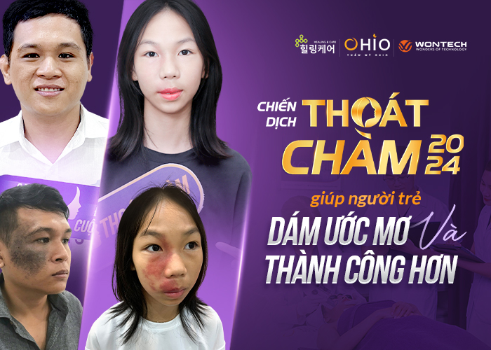 Chiến dịch Thoát Chàm 2024 giúp hàng ngàn người thay diện mạo, đổi cuộc đời - Phòng khám da liễu OHIO Chiến dịch Thoát Chàm 2024 giúp hàng ngàn người thay diện mạo, đổi cuộc đời