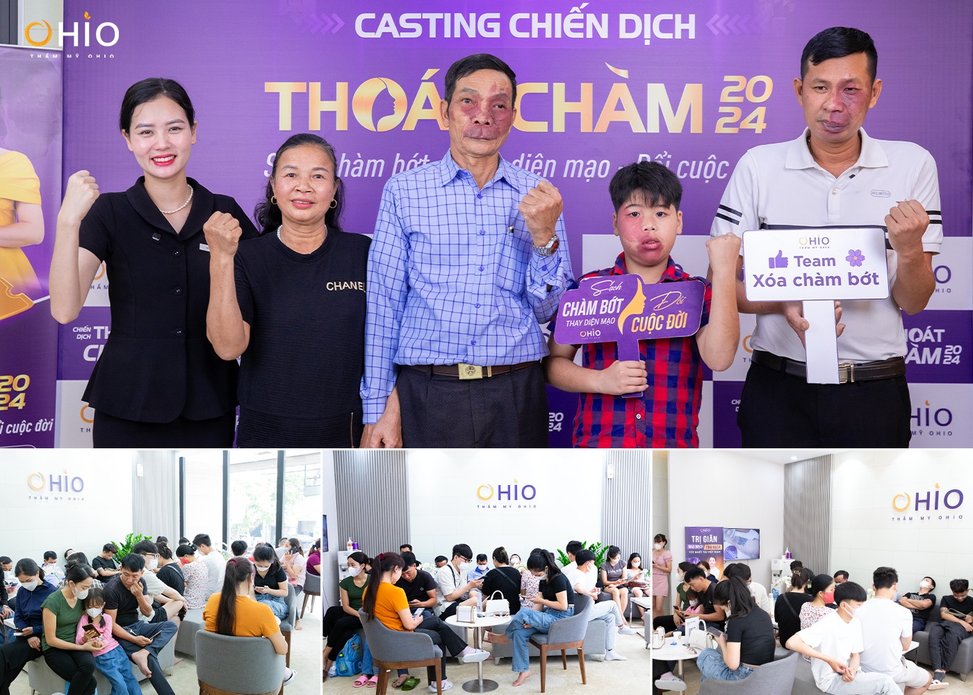 Hàng ngàn thí sinh “đổ về” casting “Chiến dịch thoát chàm” 2024 - Phòng khám da liễu OHIO Chiến Dịch Thoát Chàm