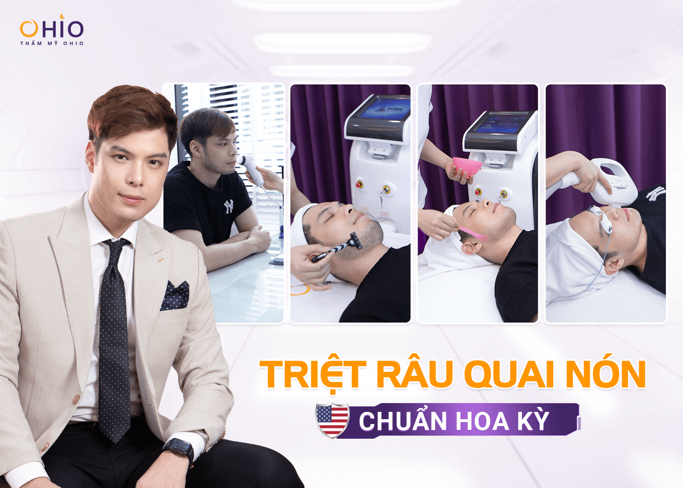 Những lưu ý sau khi triệt râu - Phòng khám da liễu OHIO Những lưu ý sau khi triệt râu