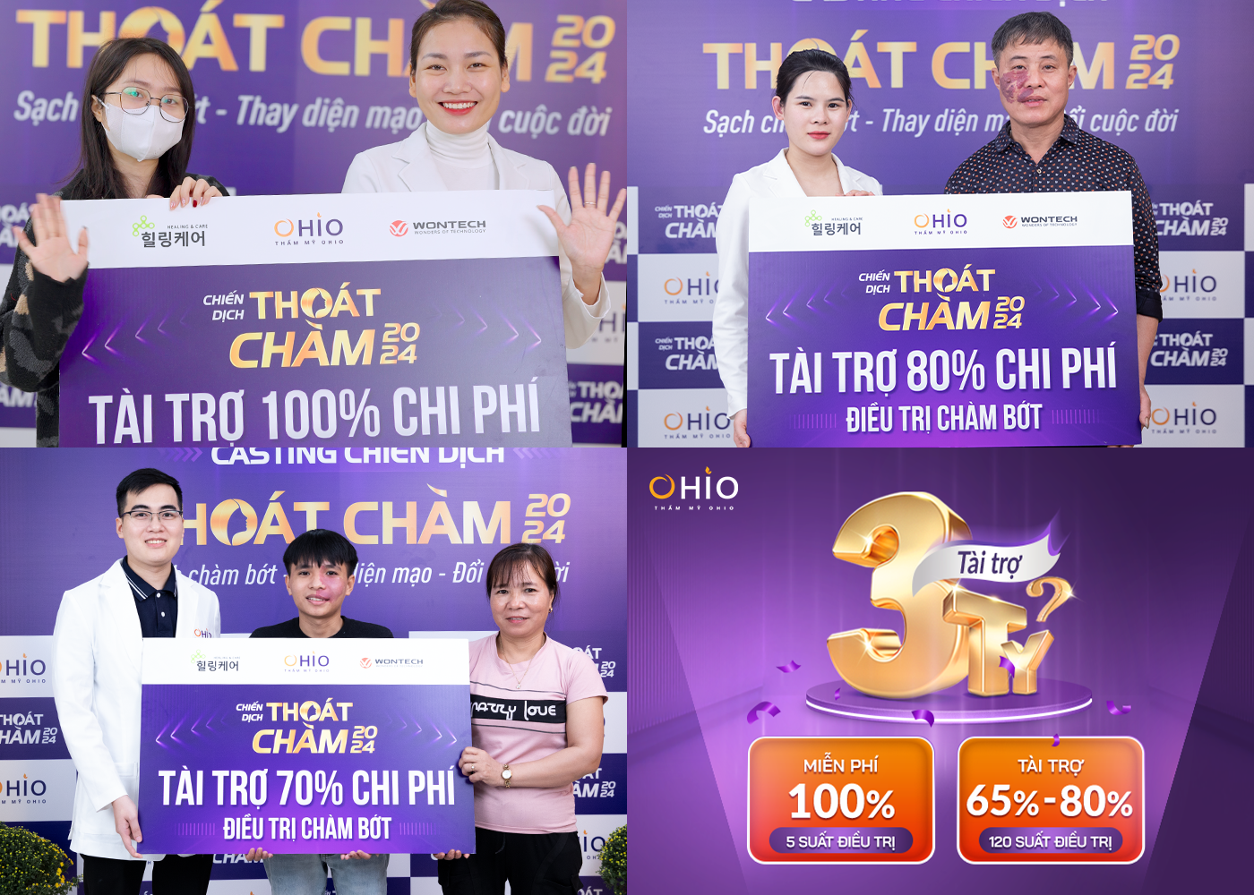 Chiến dịch Thoát chàm 2024 thực hiện hoá ước mơ cho những bệnh nhân chàm bớt sắc tố - Phòng khám da liễu OHIO Chiến dịch Thoát chàm 2024 thực hiện hoá ước mơ cho những bệnh nhân chàm bớt sắc tố