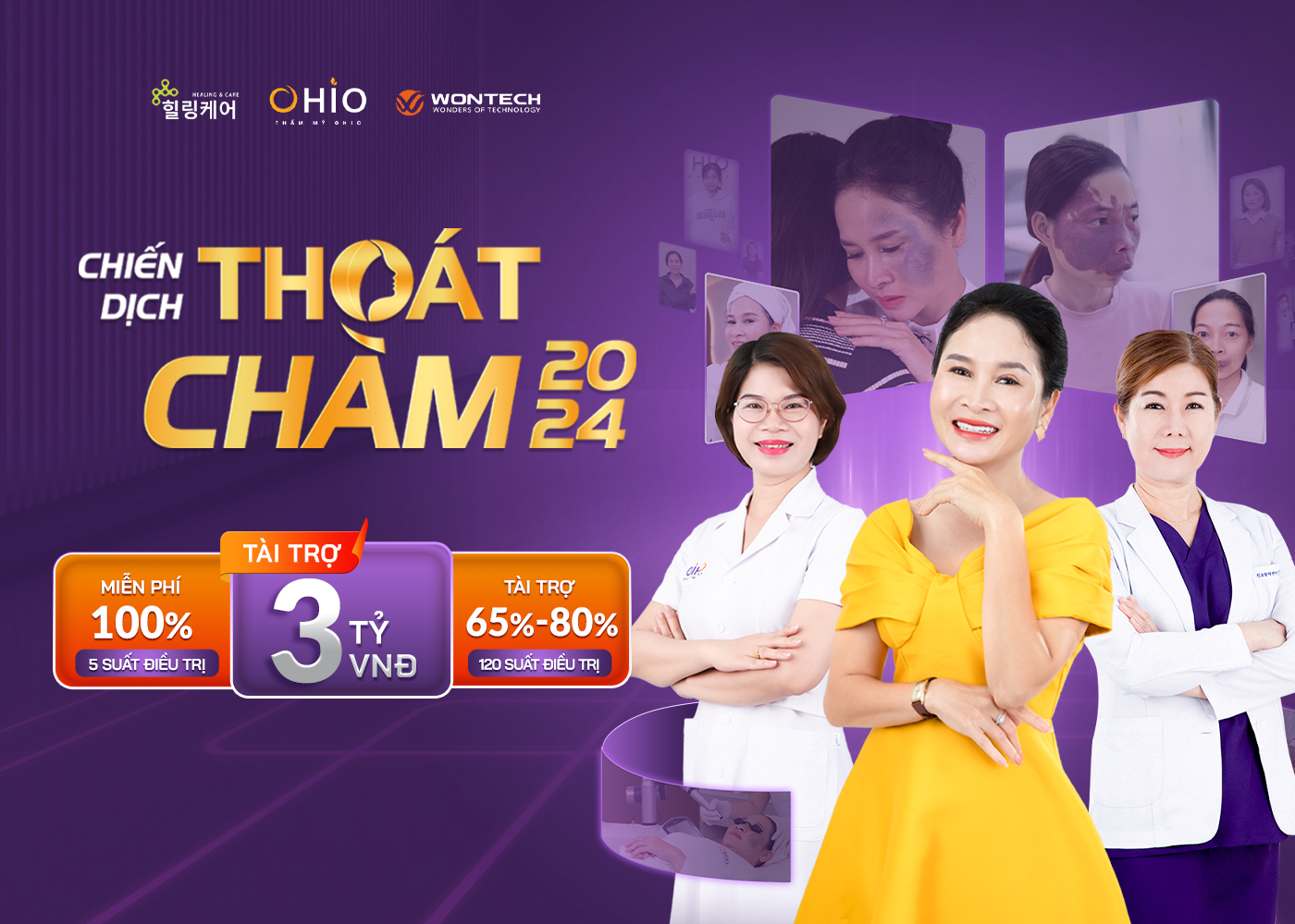 Chiến dịch Thoát chàm 2024 thực hiện hoá ước mơ cho những bệnh nhân chàm bớt sắc tố - Phòng khám da liễu OHIO Chiến dịch Thoát chàm 2024 thực hiện hoá ước mơ cho những bệnh nhân chàm bớt sắc tố