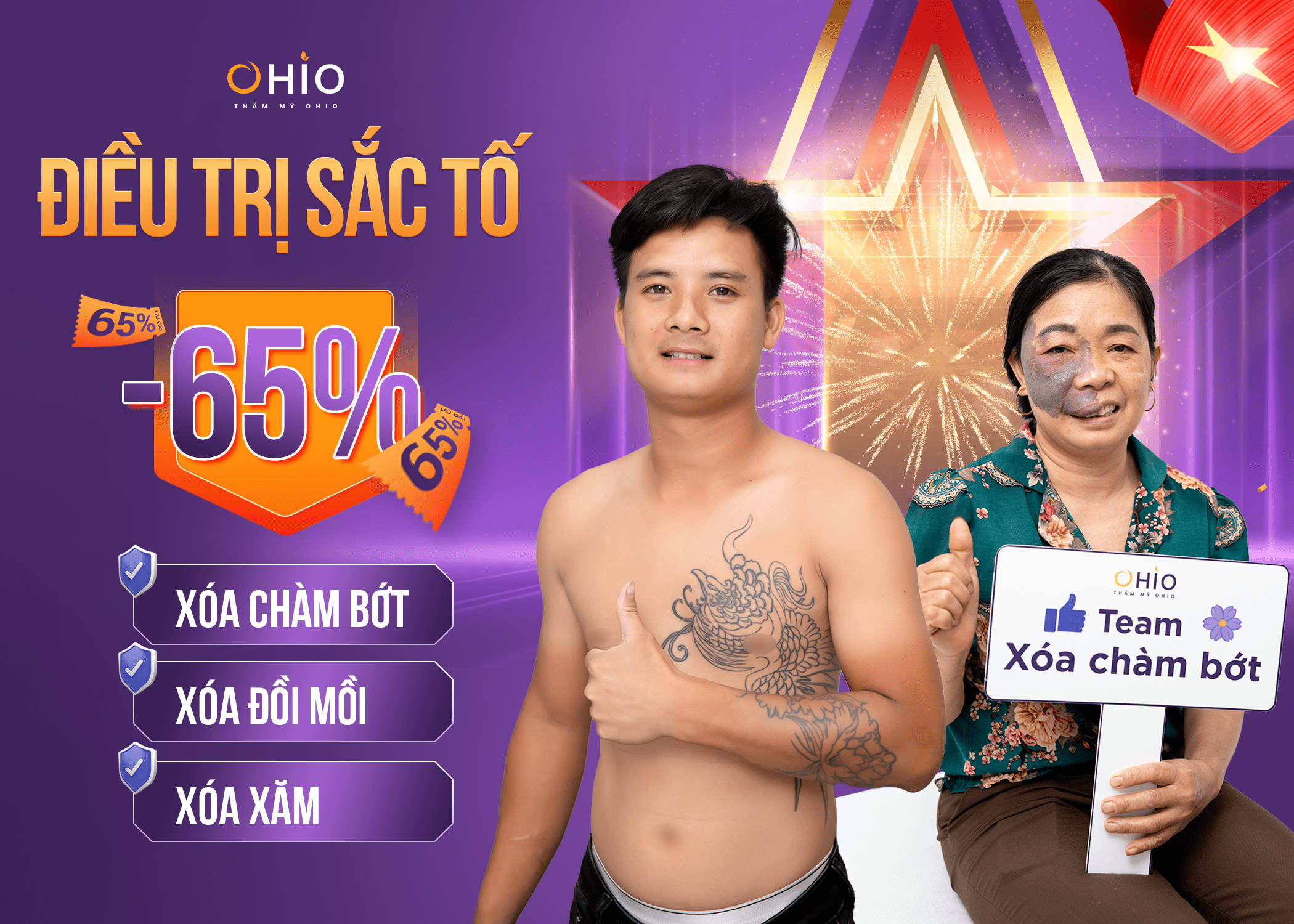 Mừng đại lễ - Đẹp ngay kẻo trễ - Giảm tới 65% chi phí làm đẹp - Phòng khám da liễu OHIO Mừng đại lễ - Đẹp ngay kẻo trễ - Giảm tới 65% chi phí làm đẹp