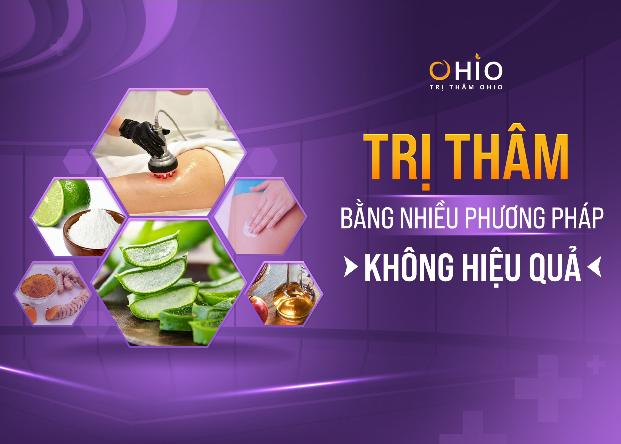 Bí quyết trị thâm mông, tự tin diện bikini của chị Hà Nhi - Phòng khám da liễu OHIO điều trị thâm mông