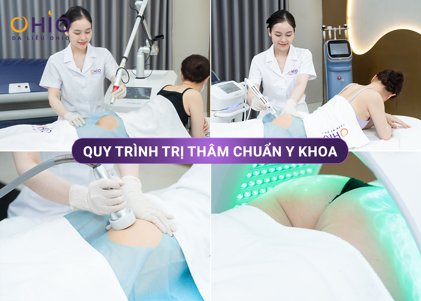 Tự tin diện bikini khoe vòng 3 trắng mịn nhờ trị thâm sần tại OHIO