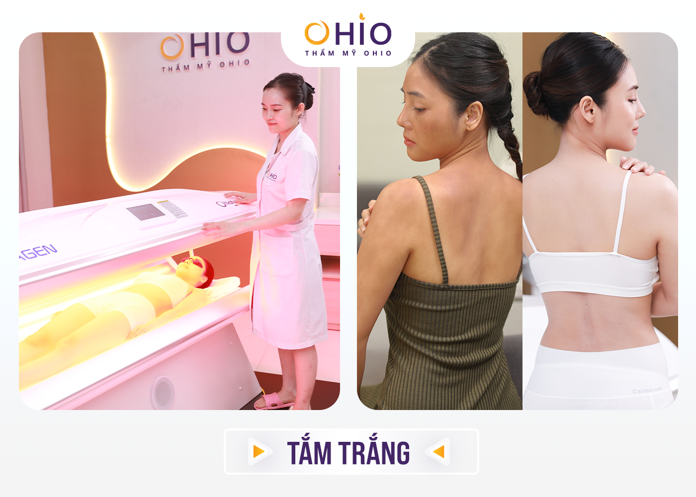 Thẩm mỹ OHIO khai trương chi nhánh thứ 4 tại Vinh, Nghệ An – Mừng hệ thống cơ sở phát triển rộng khắp 3 miền đất nước - Phòng khám da liễu OHIO Thẩm mỹ OHIO khai trương chi nhánh thứ 4 tại Vinh, Nghệ An – Mừng hệ thống cơ sở phát triển rộng khắp 3 miền đất nước