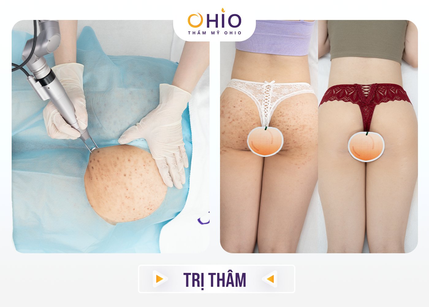 Thẩm mỹ OHIO khai trương chi nhánh thứ 4 tại Vinh, Nghệ An – Mừng hệ thống cơ sở phát triển rộng khắp 3 miền đất nước - Phòng khám da liễu OHIO Thẩm mỹ OHIO khai trương chi nhánh thứ 4 tại Vinh, Nghệ An – Mừng hệ thống cơ sở phát triển rộng khắp 3 miền đất nước