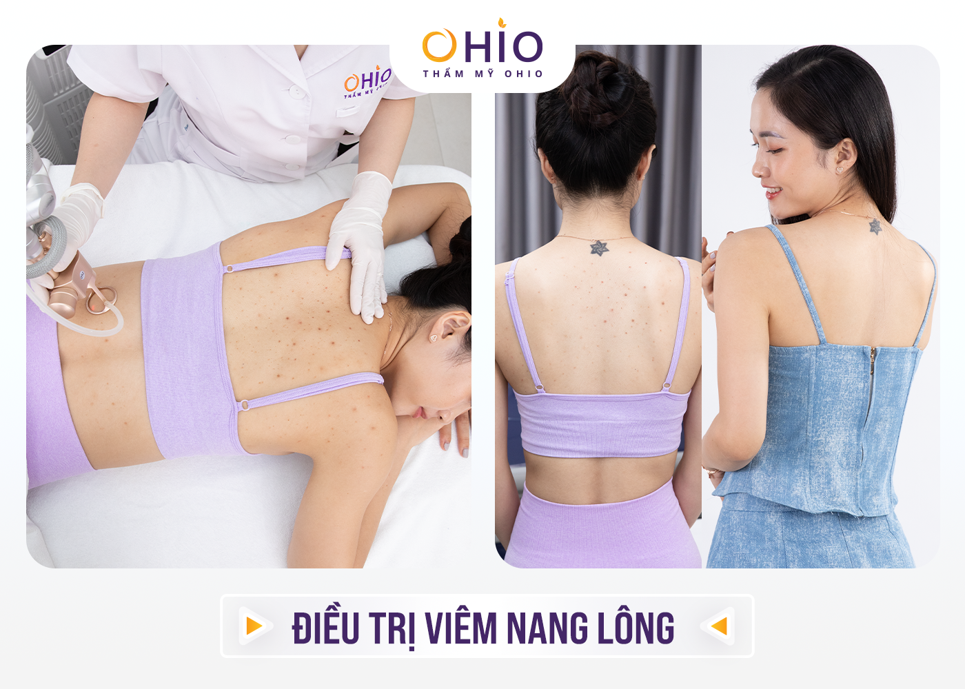 Thẩm mỹ OHIO khai trương chi nhánh thứ 4 tại Vinh, Nghệ An – Mừng hệ thống cơ sở phát triển rộng khắp 3 miền đất nước - Phòng khám da liễu OHIO Thẩm mỹ OHIO khai trương chi nhánh thứ 4 tại Vinh, Nghệ An – Mừng hệ thống cơ sở phát triển rộng khắp 3 miền đất nước