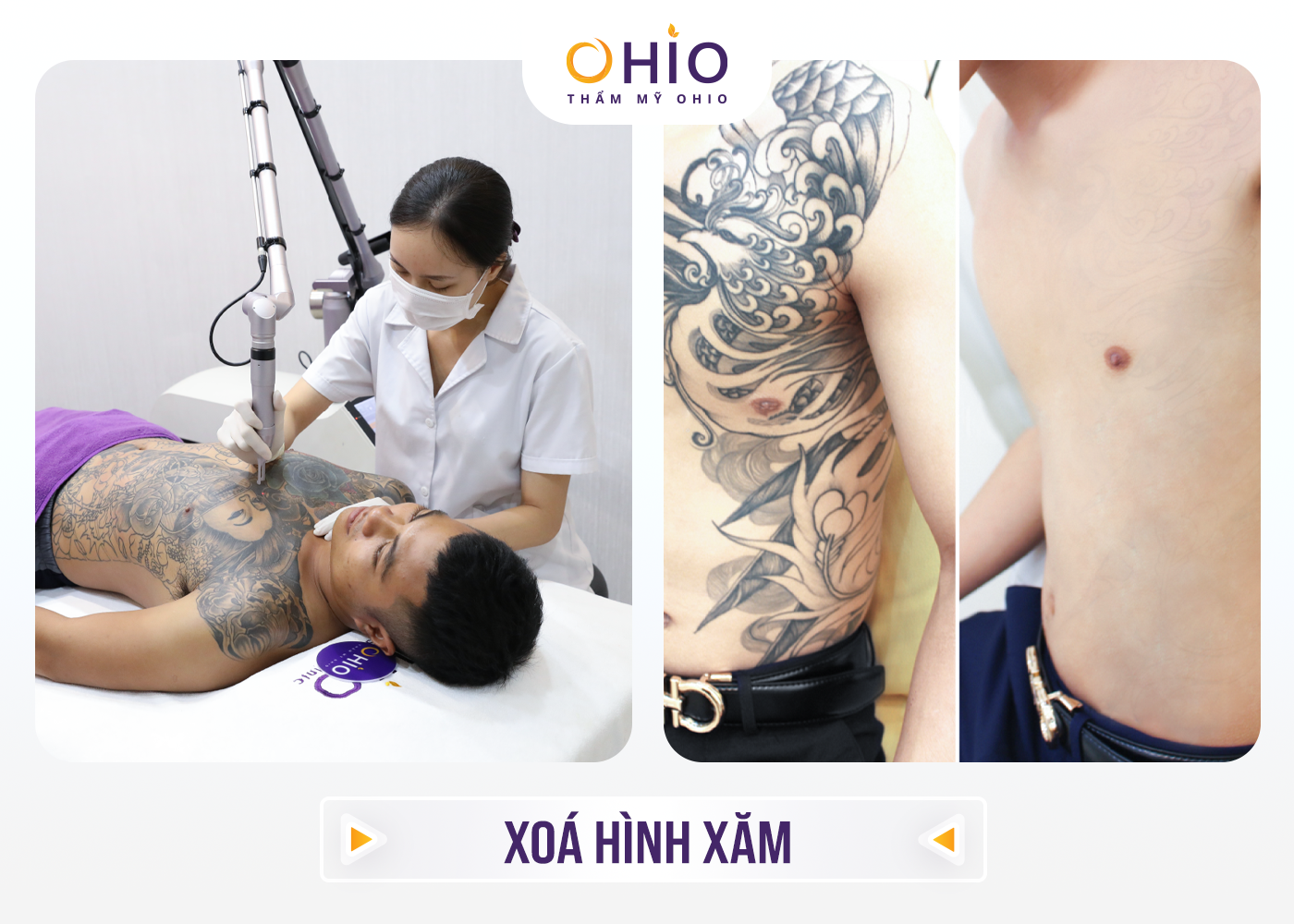 Thẩm mỹ OHIO khai trương chi nhánh thứ 4 tại Vinh, Nghệ An – Mừng hệ thống cơ sở phát triển rộng khắp 3 miền đất nước - Phòng khám da liễu OHIO Thẩm mỹ OHIO khai trương chi nhánh thứ 4 tại Vinh, Nghệ An – Mừng hệ thống cơ sở phát triển rộng khắp 3 miền đất nước