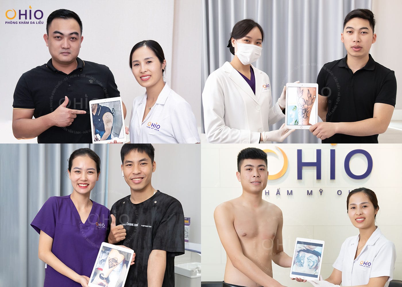 Xoá xăm an toàn, hiệu quả tại Vinh - Nghệ An - Phòng khám da liễu OHIO Tổng hợp các ca xóa xăm không đau