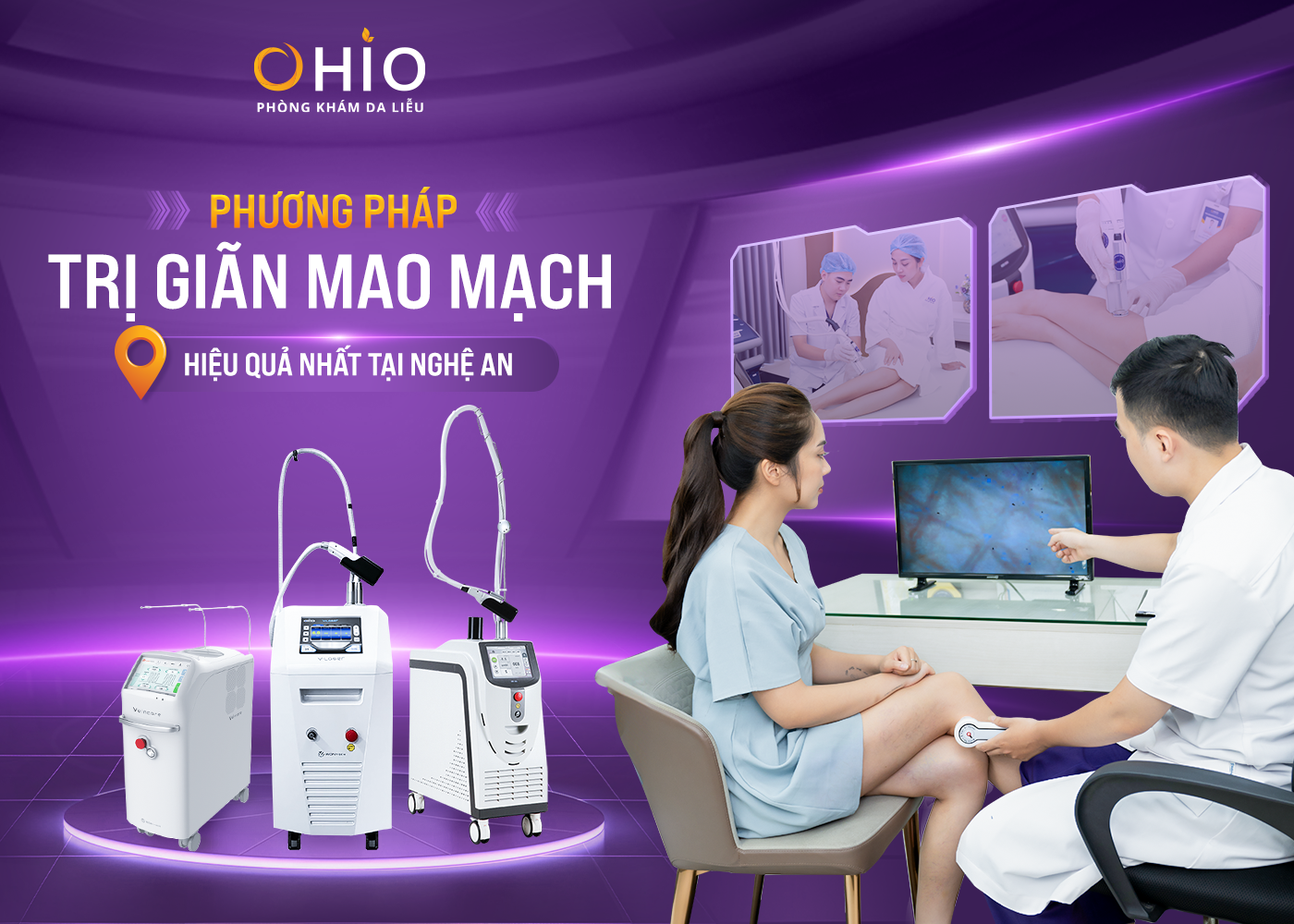 Phương pháp điều trị giãn mao mạch chi dưới hiệu quả tại Nghệ An - Phòng khám da liễu OHIO phương pháp điều trị giãn mao mạch chi dưới