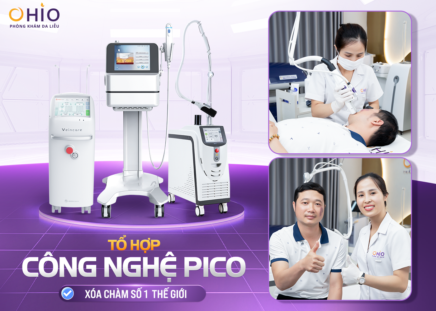 Xóa chàm bớt hiệu quả tại Nghệ An - Phòng khám da liễu OHIO bớt sắc tố bẩm sinh