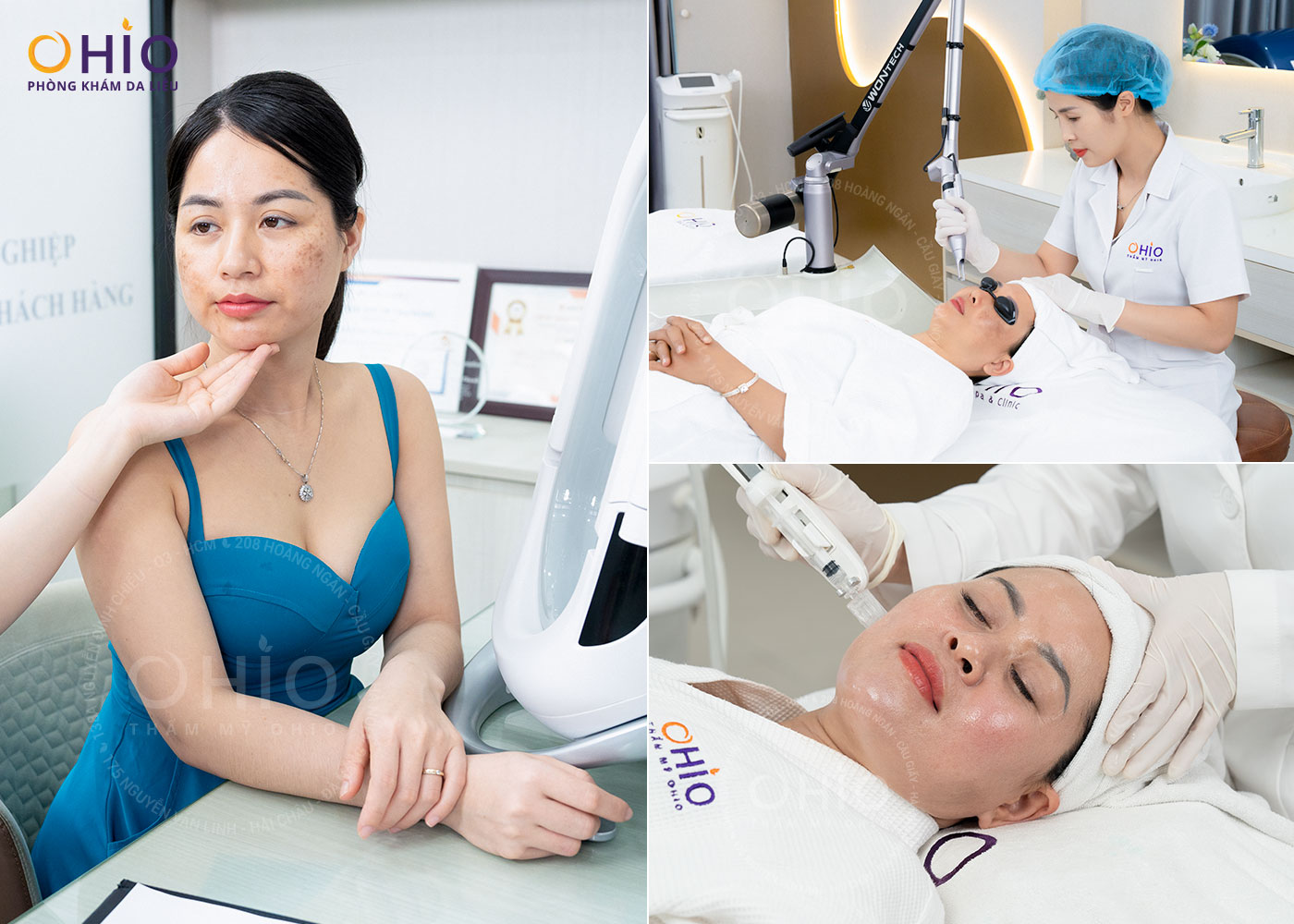 Mừng Sinh Nhật - Trao Giá Trị Thật! Giảm Tới 69% Chi Phí Làm Đẹp Tại Phòng khám da liễu OHIO! - Phòng khám da liễu OHIO Mừng Sinh Nhật - Trao Giá Trị Thật! Giảm Tới 69% Chi Phí Làm Đẹp Tại Phòng khám da liễu OHIO!