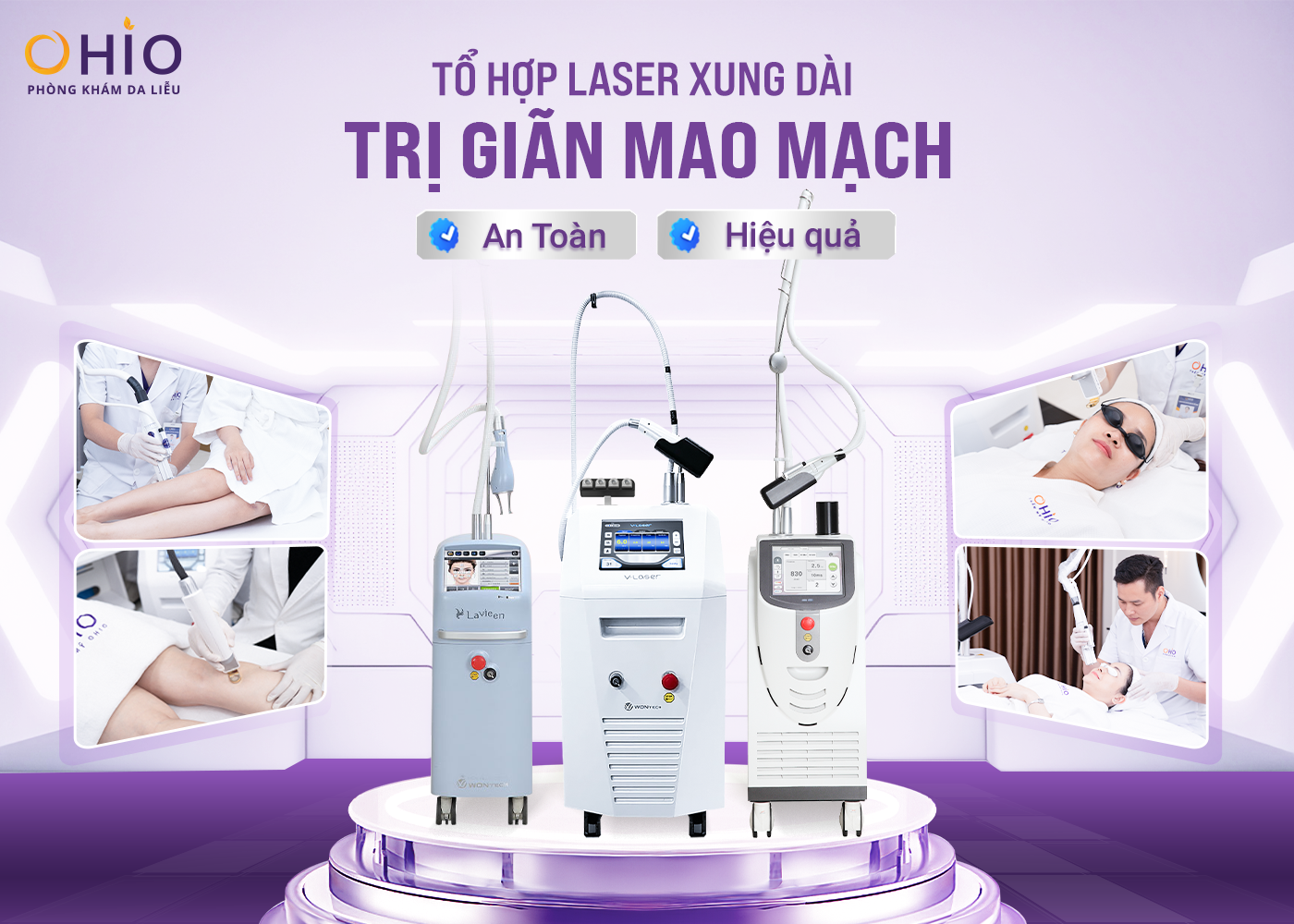 Trị giãn mao mạch Tổ hợp laser xung dài - An toàn, hiệu quả - Phòng khám da liễu OHIO Trị giãn mao mạch Tổ hợp laser xung dài - An toàn, hiệu quả