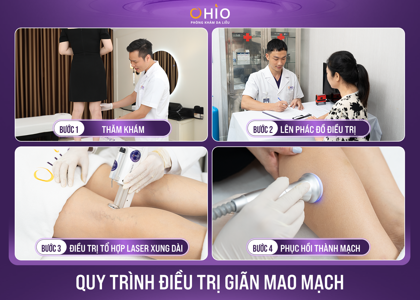Trị giãn mao mạch Tổ hợp laser xung dài - An toàn, hiệu quả - Phòng khám da liễu OHIO Trị giãn mao mạch Tổ hợp laser xung dài - An toàn, hiệu quả